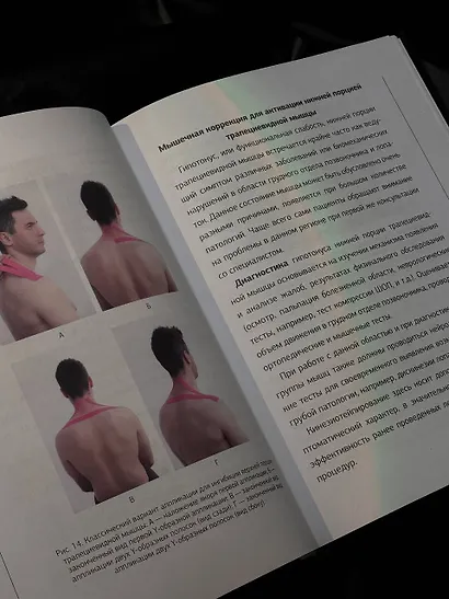 Тейп всему голова. Руководство по наложению волшебных ленточек - фото 6