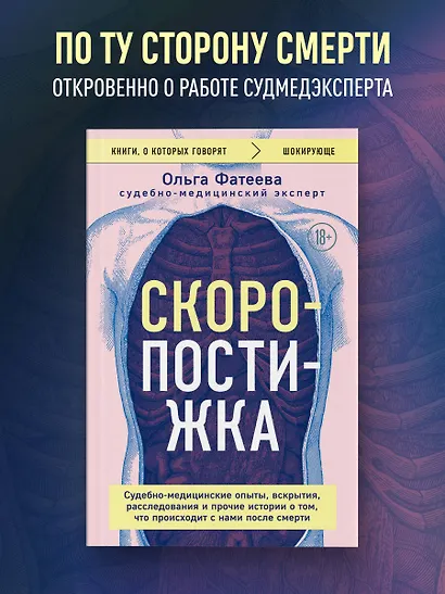 Скоропостижка. Судебно-медицинские опыты, вскрытия, расследования и прочие истории о том, что происходит с нами после смерти - фото 4
