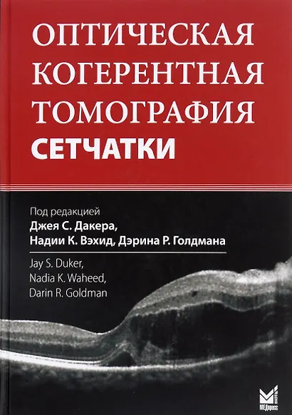 Оптическая когерентная томография сетчатки - фото 1