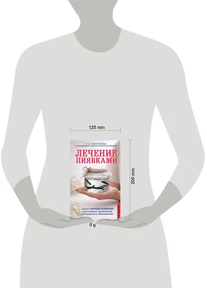 Лечение пиявками. Схемы гирудотерапии при сложных, хронических и запущенных заболеваниях - фото 4