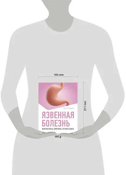 Язвенная болезнь. Факторы риска, симптомы, лечение и диета - фото 6