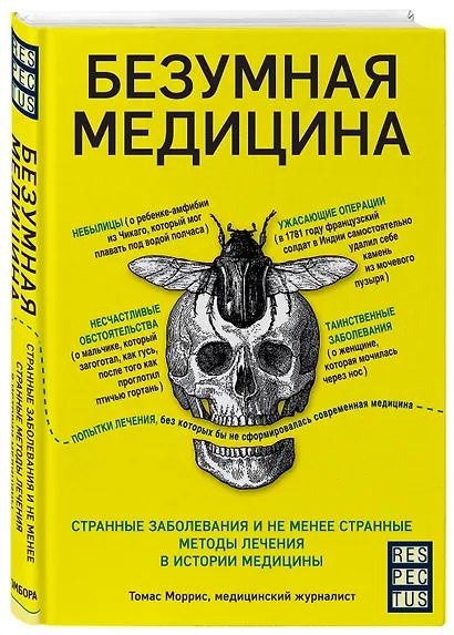 Безумная медицина. Странные заболевания и не менее странные методы лечения в истории медицины - фото 3
