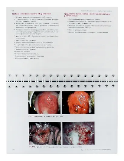 Кольпоскопия: руководство для практикующих врачей - фото 6