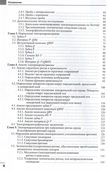 Электрокардиография - фото 3