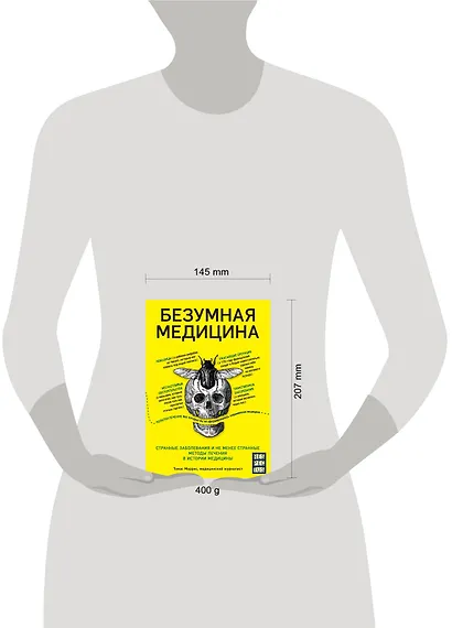Безумная медицина. Странные заболевания и не менее странные методы лечения в истории медицины - фото 4