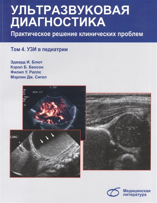 Ультразвуковая диагностика. Практическое решение клинических проблем, т. 4. УЗИ в педиатрии