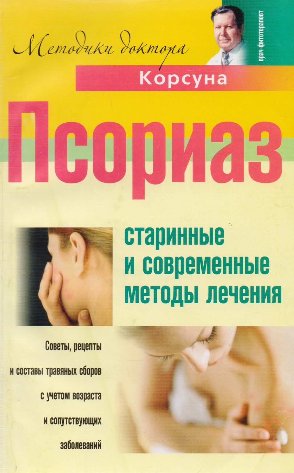 Псориаз. Старинные и современные методы лечения. Корсун В.Ф., Корсун Е.В.,  Суворов А.П. (Корсун Владимир Федорович, Суворов Александр Павлович, Корсун  Елена Владимировна). ISBN: 978-5-9524-2663-4 ➠ купите эту книгу с доставкой  в интернет-магазине ...