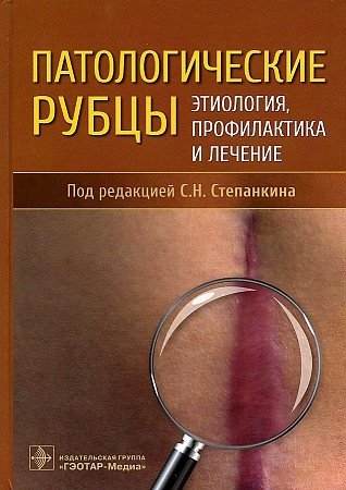 Степанкин С.Н. Патологические рубцы. Этиология, профилактика и лечение