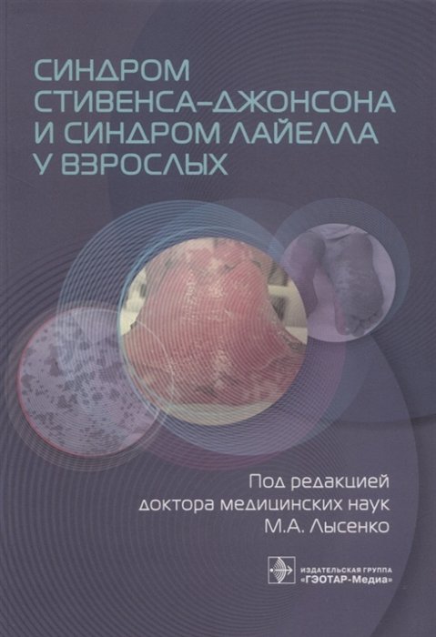 Лысенко М.А.,Фомина Д.С.,Проценко Д.Н.: Под ред.М.А.Лысенко - Синдром Стивенса–Джонсона и синдром Лайелла у взрослых