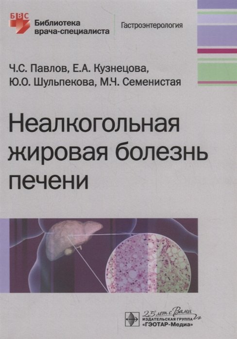 Павлов Ч., Кузнецова Е., Шульпекова Ю. - Неалкогольная жировая болезнь печени