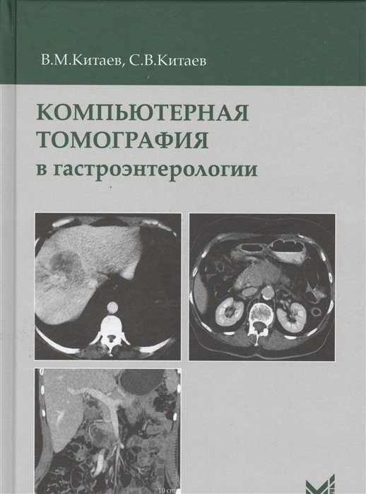 Китаев В., Китаев С. - Компьютерная томография в гастроэнтерологии. Руководство для врачей