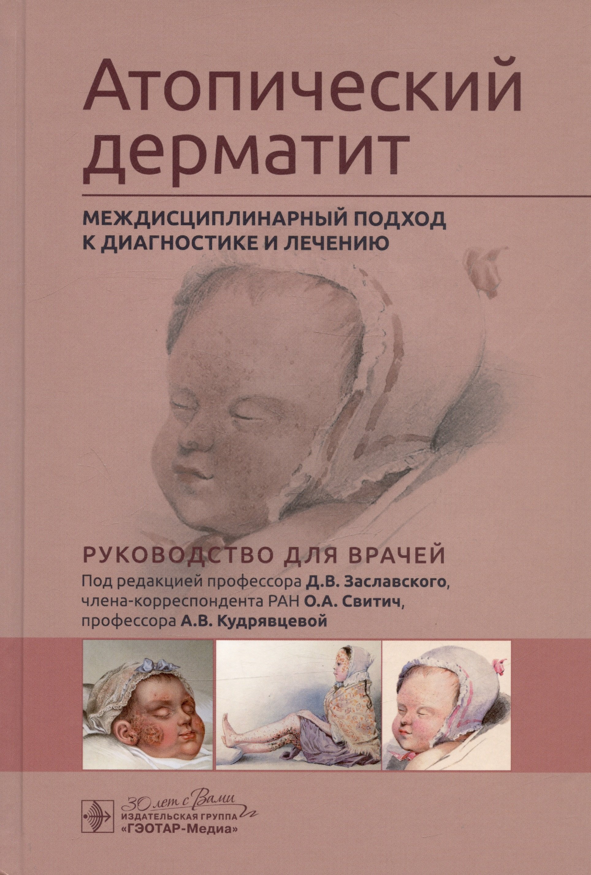 

Атопический дерматит. Междисциплинарный подход к диагностике и лечению. Руководство для врачей