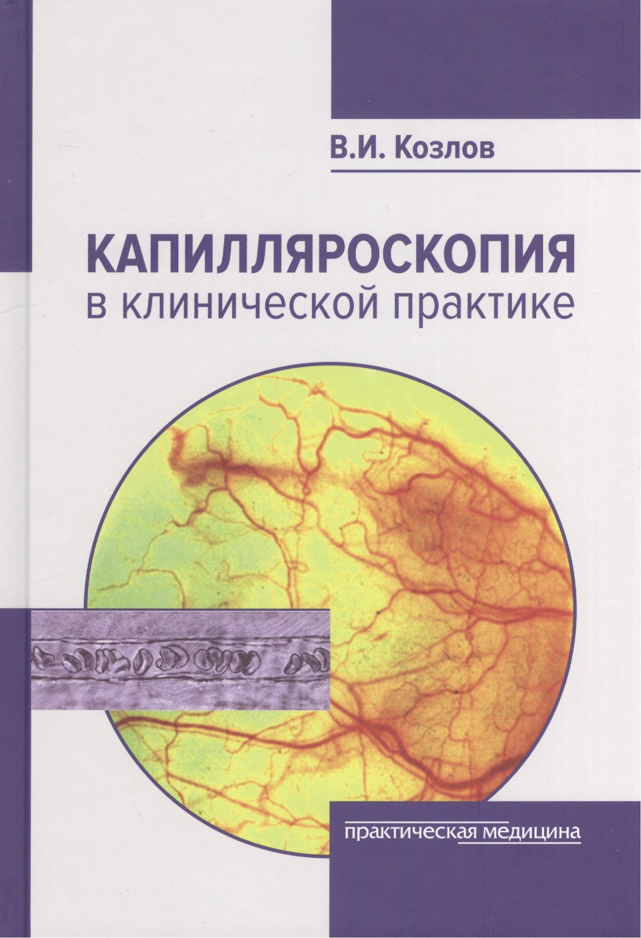 

Капилляроскопия в клинической практике