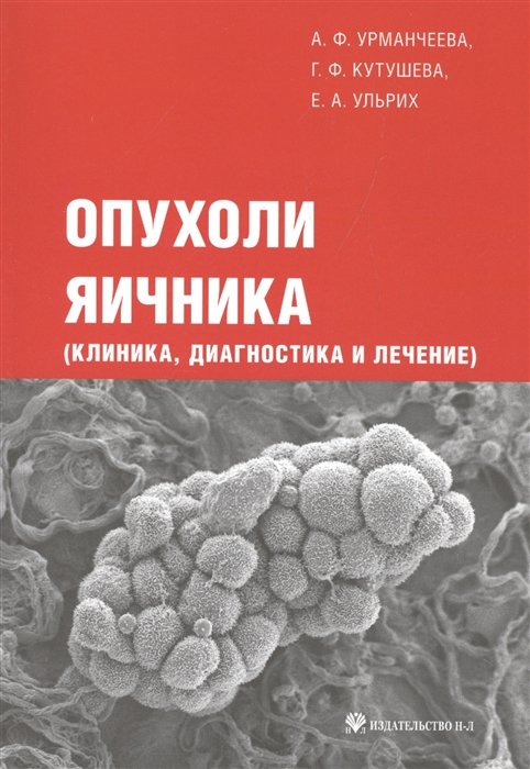 Опухоли яичника (клиника, диагностика и лечение)