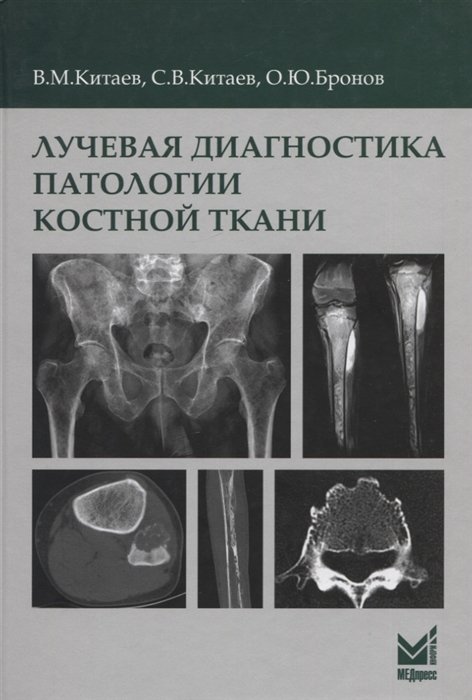 

Лучевая диагностика патологии костной ткани