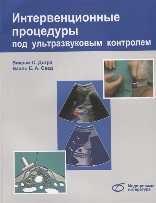 Интервенционные процедуры под ультразвуковым контролем (м) Догра
