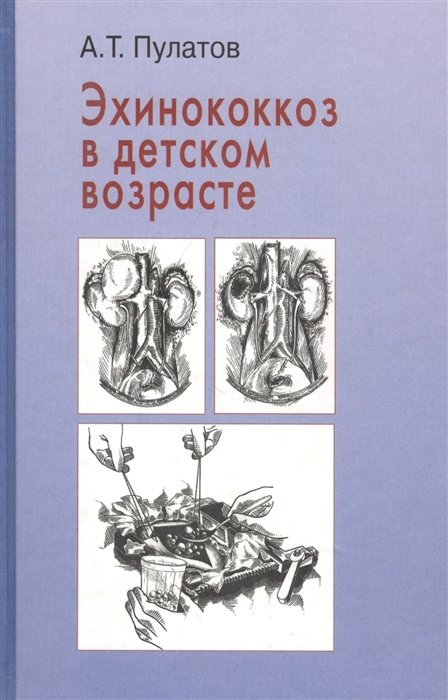 

Эхинококкоз в детском возрасте