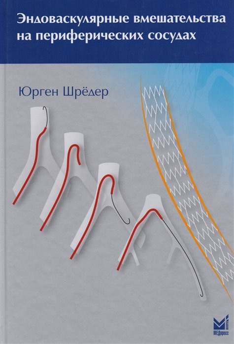 Шредер Ю. - Эндоваскулярные вмешательства на периферических сосудах