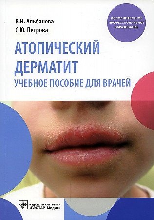 Альбанова В.И.,Петрова С.Ю. Атопический дерматит. Учебное пособие для врачей