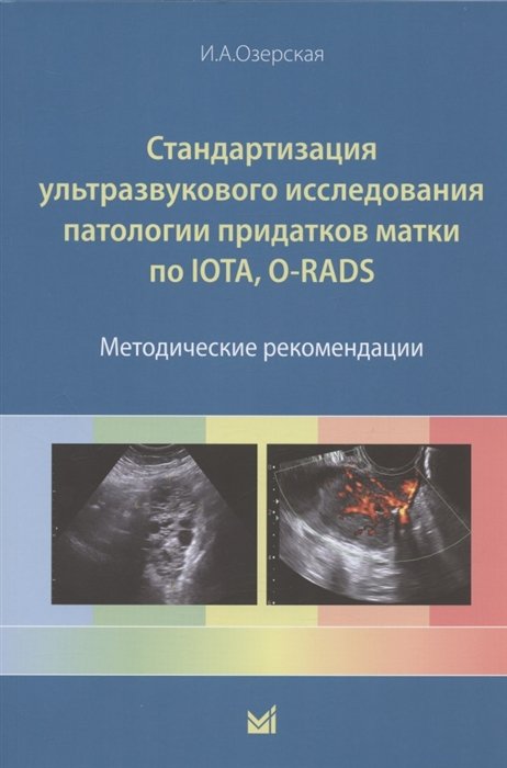 Озерская И.А. - Стандартизация ультразвукового исследования патологии придатков матки по IOTA, O-RADS. Методические рекомендации