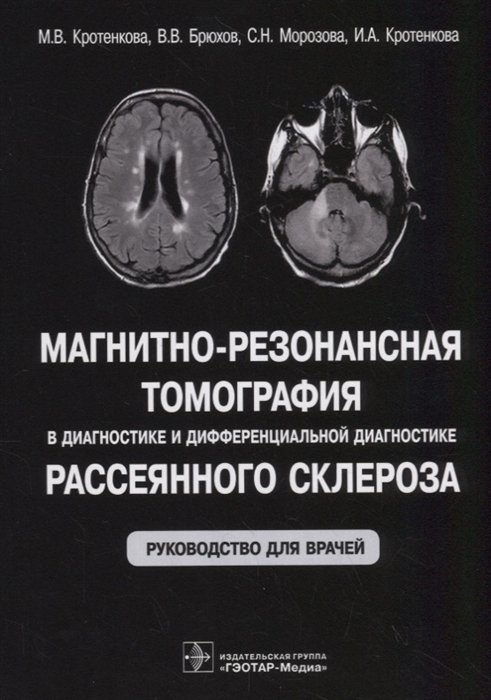 Кротенкова М., Брюхов В., Морозова С. - Магнитно-резонансная томография в диагностике и дифференциальной диагностике рассеянного склероза. Руководство для врачей