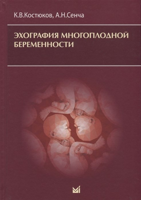 Костюков К., Сенча А. - Эхография многоплодной беременности