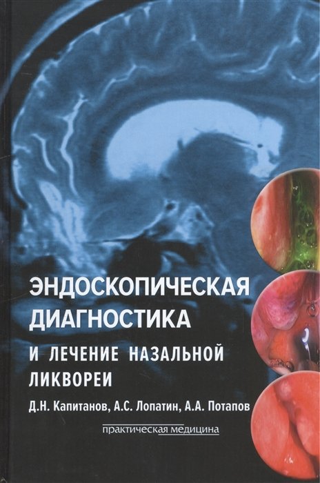 Капитанов Д., Лопатин А., Потапов А. - Эндоскопическая диагностика и лечение назальной ликвореи