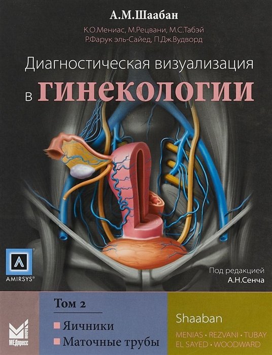 Шаабан А. - Диагностическая визуализация в гинекологии. Том 2. Яичники. Маточные трубы