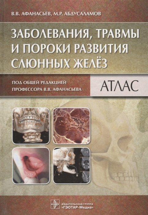 Афанасьев В., Абдусаламов М. - Заболевания, травмы и пороки развития слюнных желез. Атлас