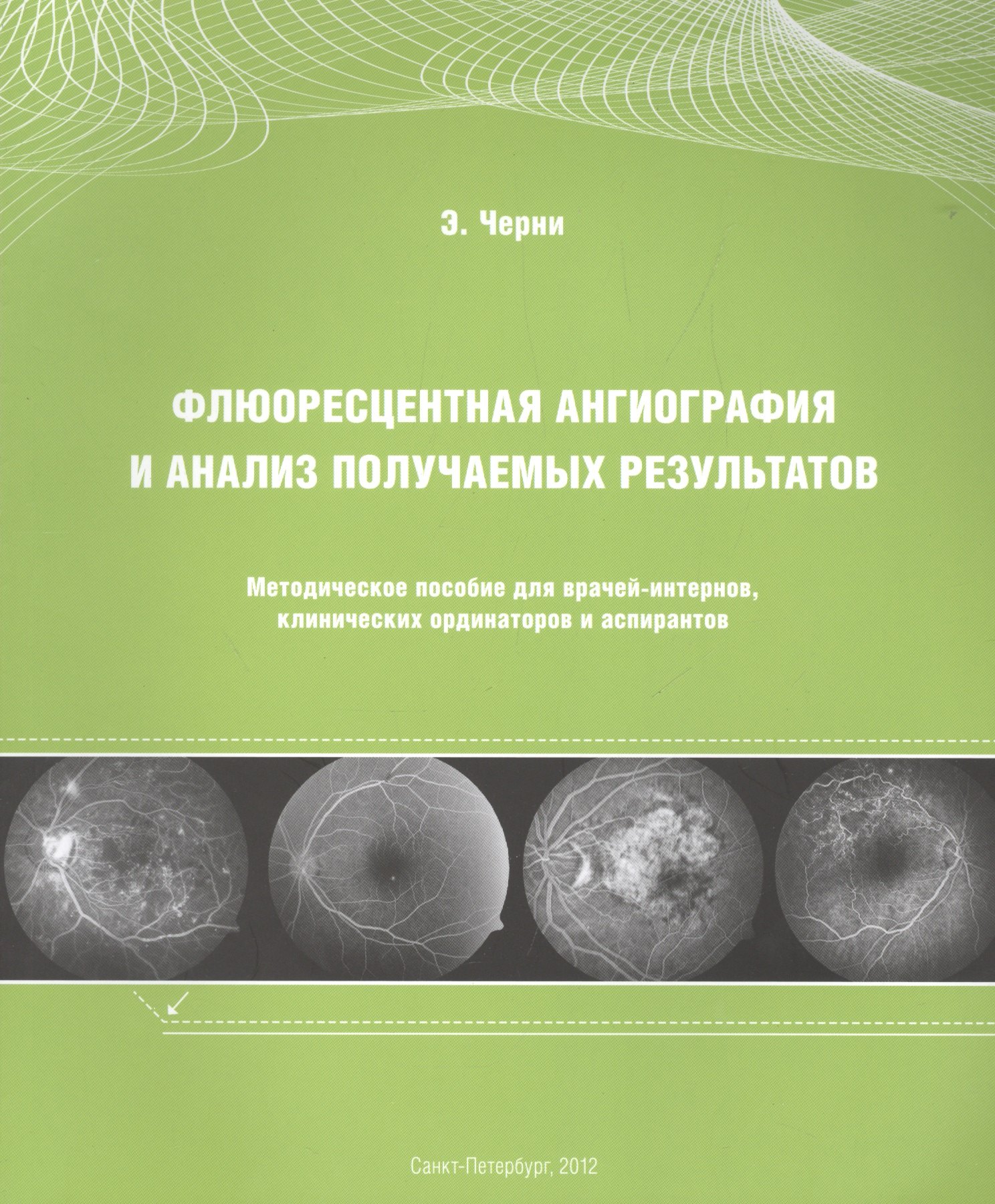 Флюоресцентная ангиография и анализ получаемых результатов: Методическое пособие для врачей-интернов, клинических ординаторов и аспирантов