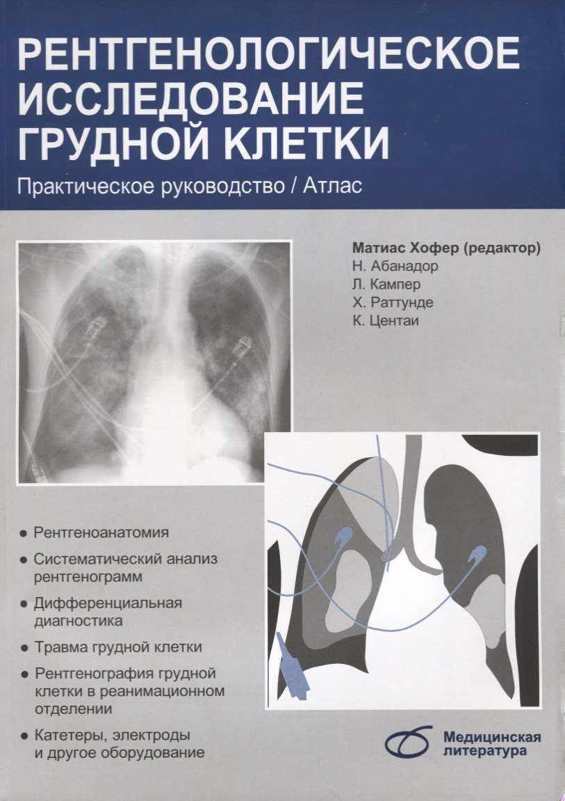 

Рентгенологическое исследование грудной клетки