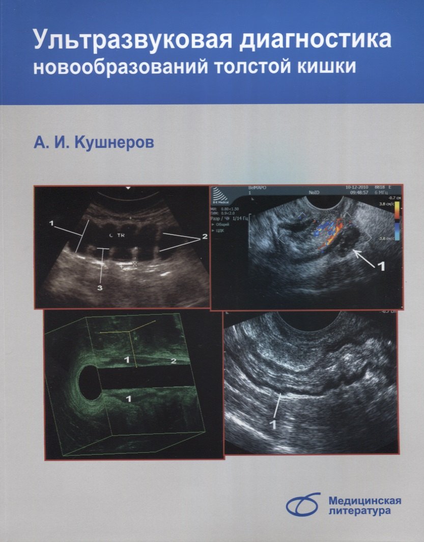 

Ультразвуковая диагностика новообразований толстой кишки