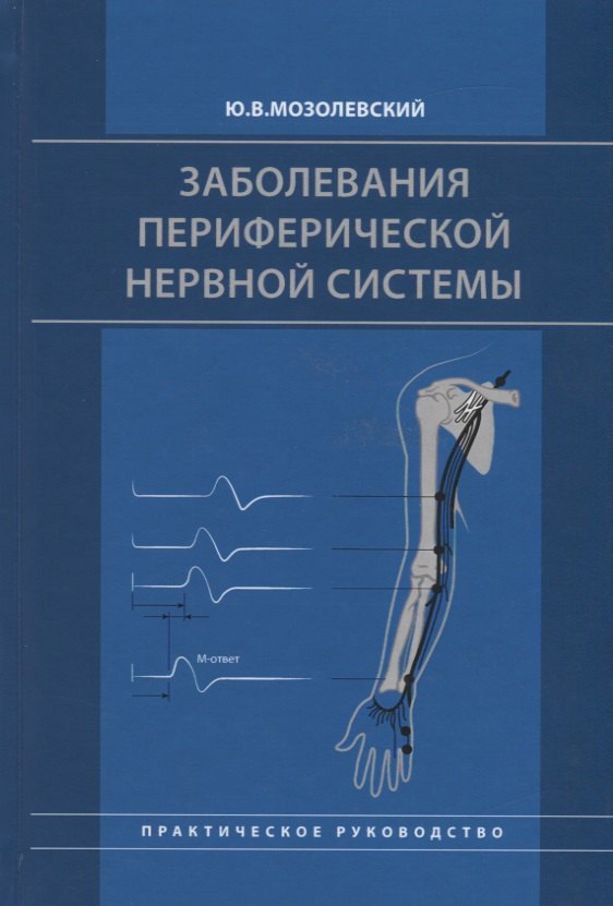 Заболевания периферической нервной системы Практическое руководство 1471₽