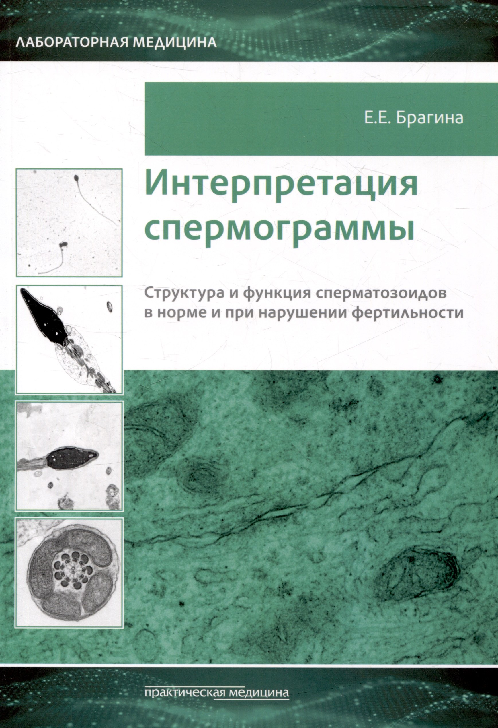 

Интерпретация спермограммы. Структура и функция сперматозоидов в норме и при нарушении фертильности