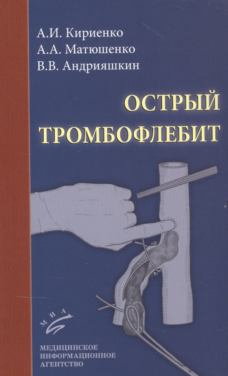 Кириенко Александр Иванович: Острый тромбофлебит