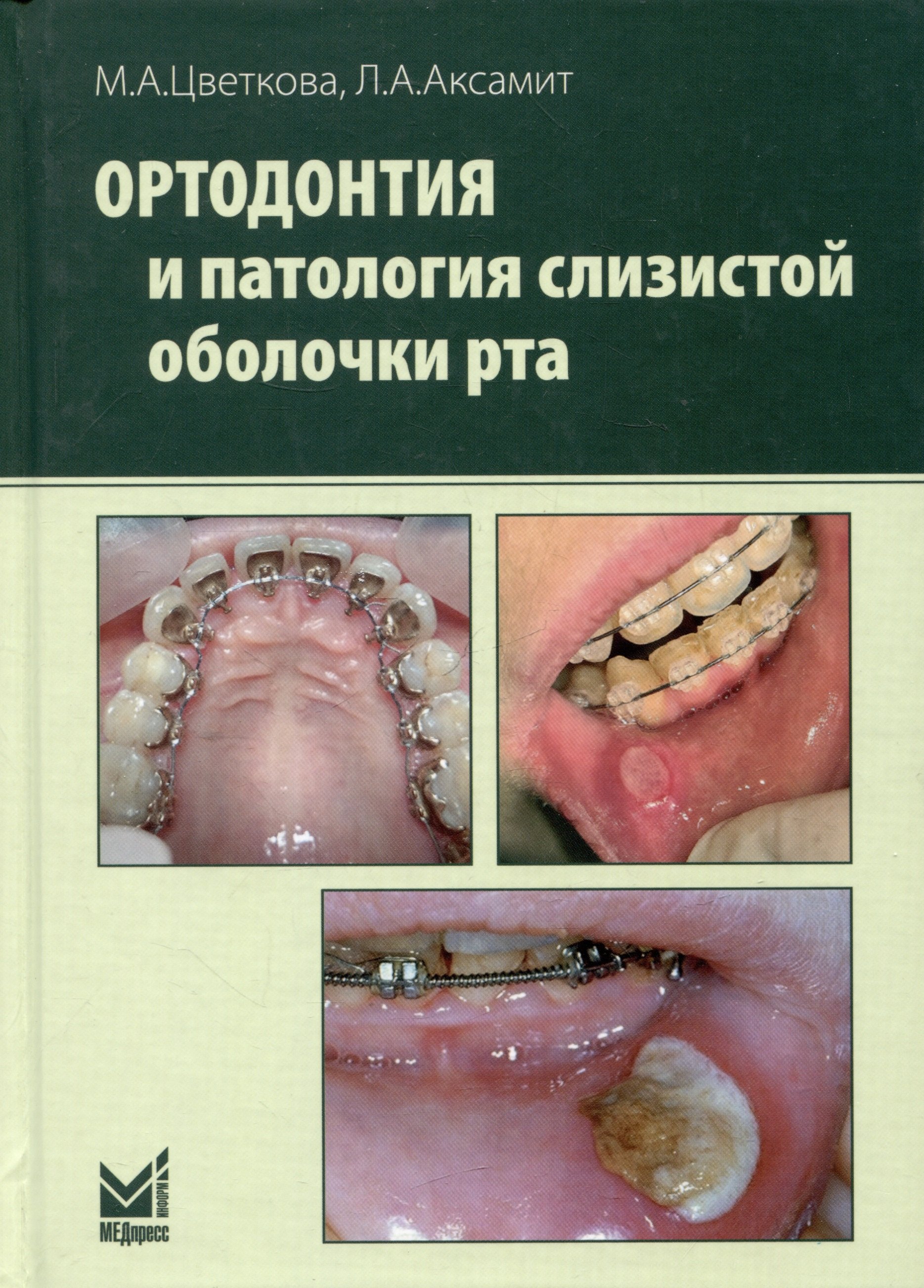 Ортодонтия и патология слизистой оболочки рта 1471₽
