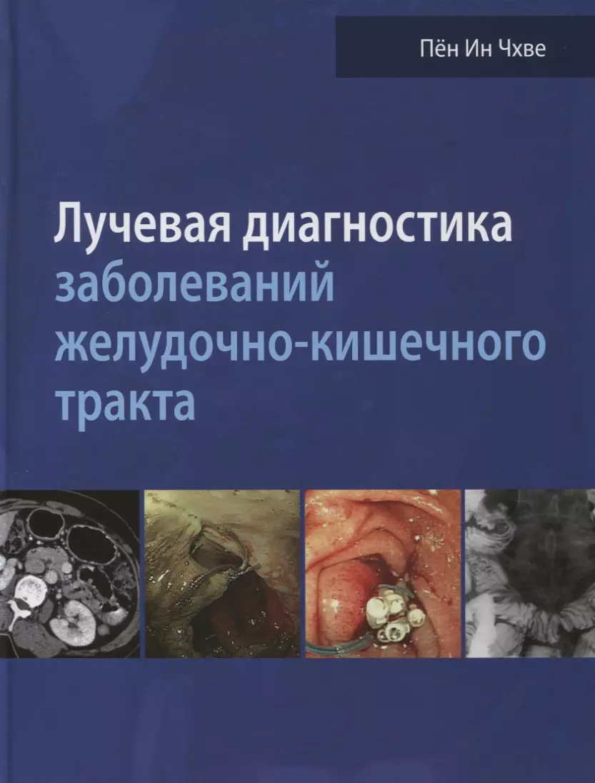 Лучевая диагностика заболеваний желудочно-кишечного тракта