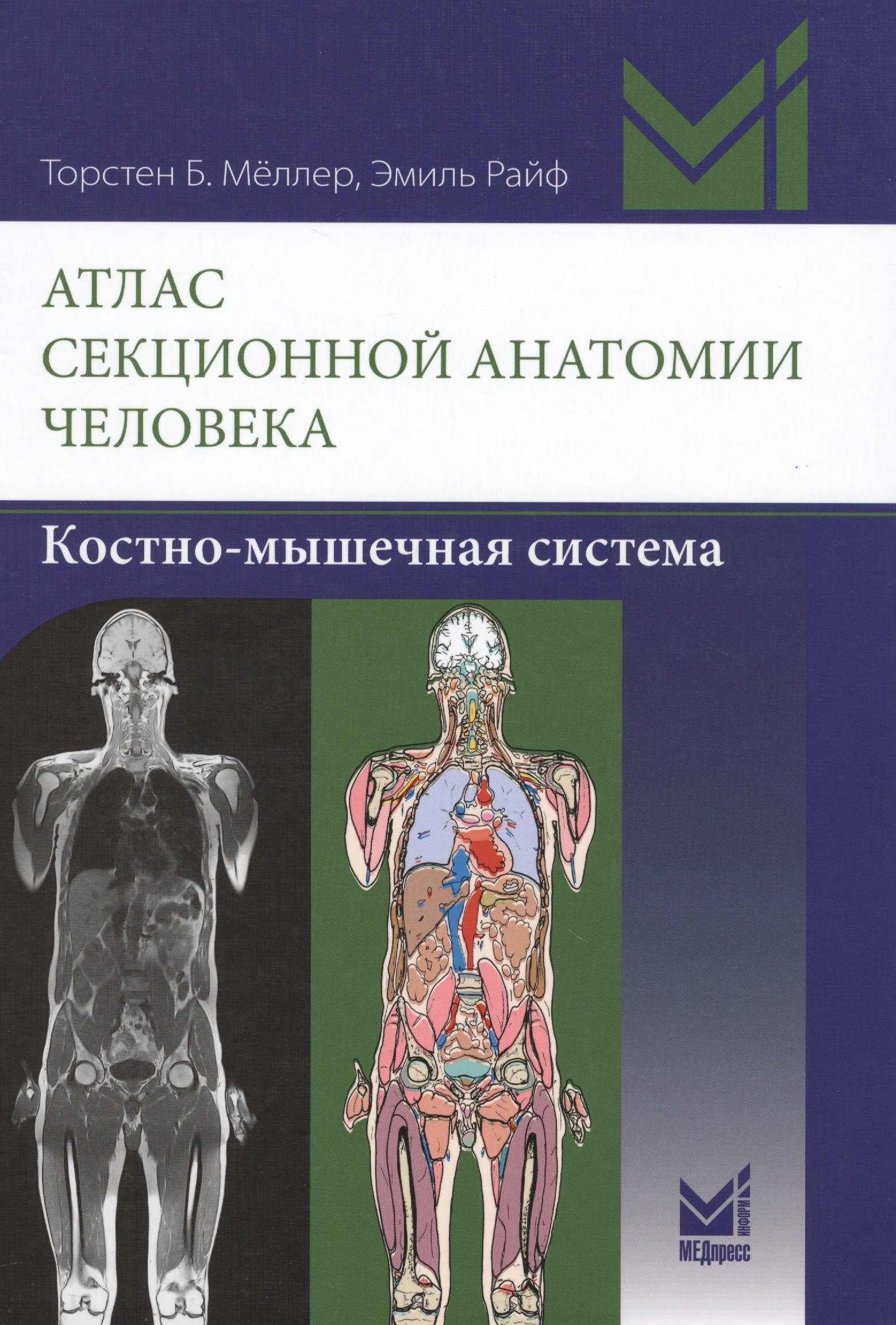 Атлас секционной анатомии человека Костно-мышечная система 3771₽