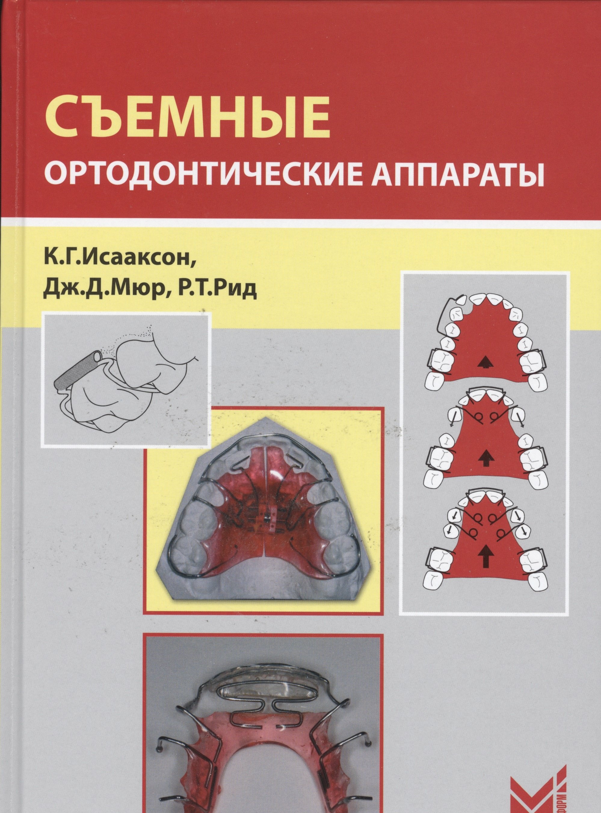 

Съемные ортодонтические аппараты
