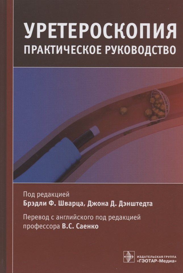 

Уретероскопия: практическое руководство