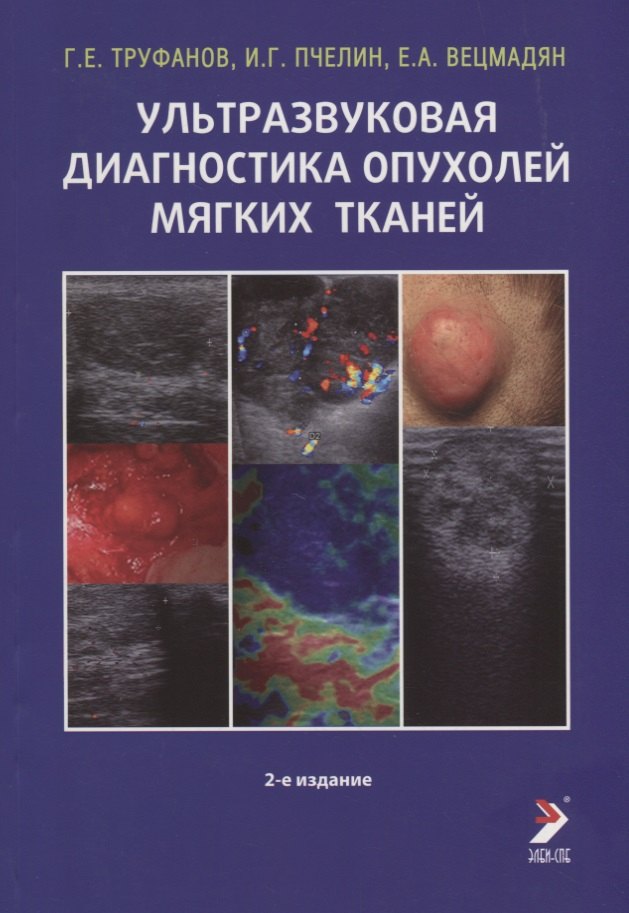 Труфанов Геннадий Евгеньевич: Ультразвуковая диагностика опухолей мягких тканей