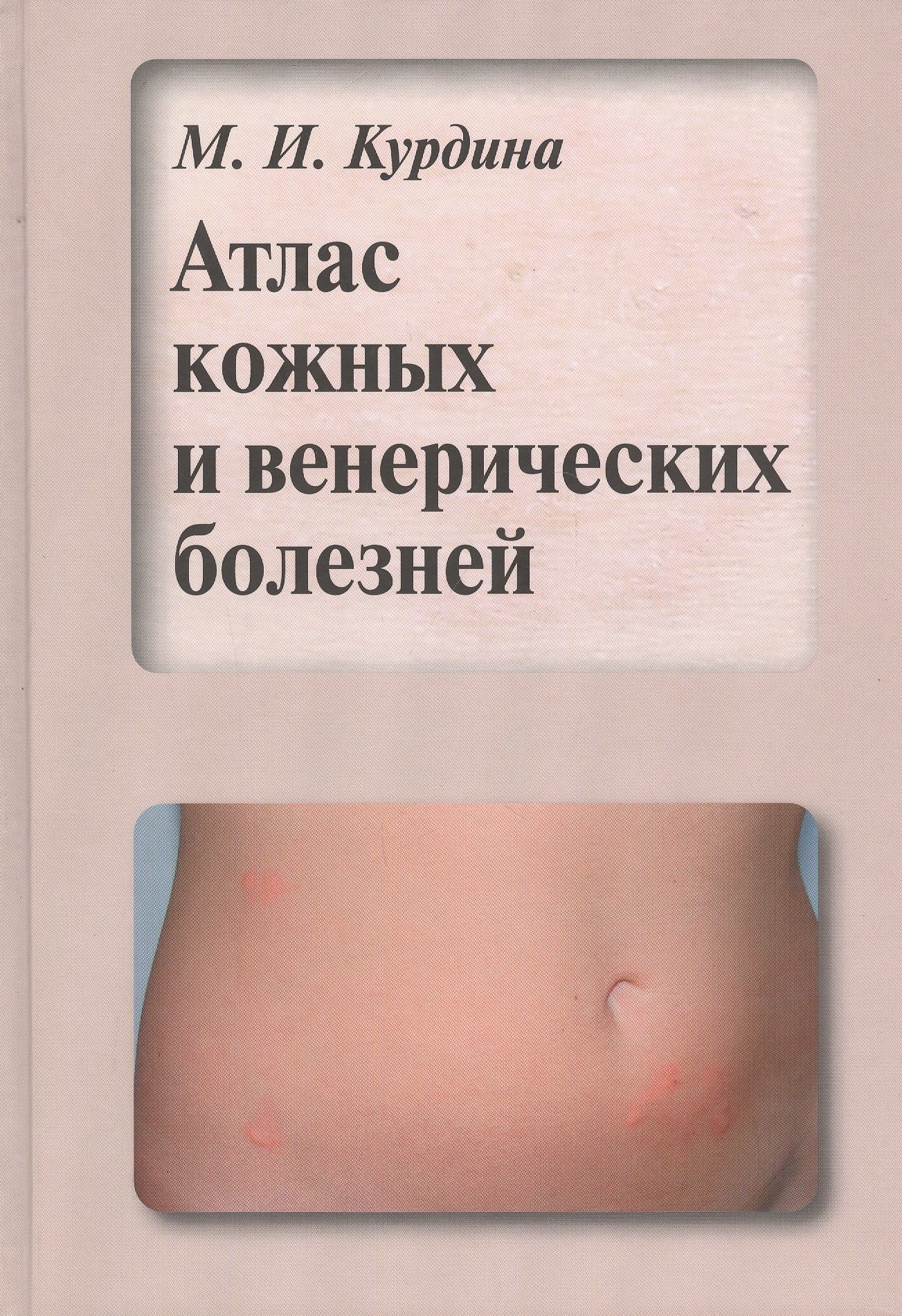 

Атлас кожных и венерических болезней. Учебное пособие
