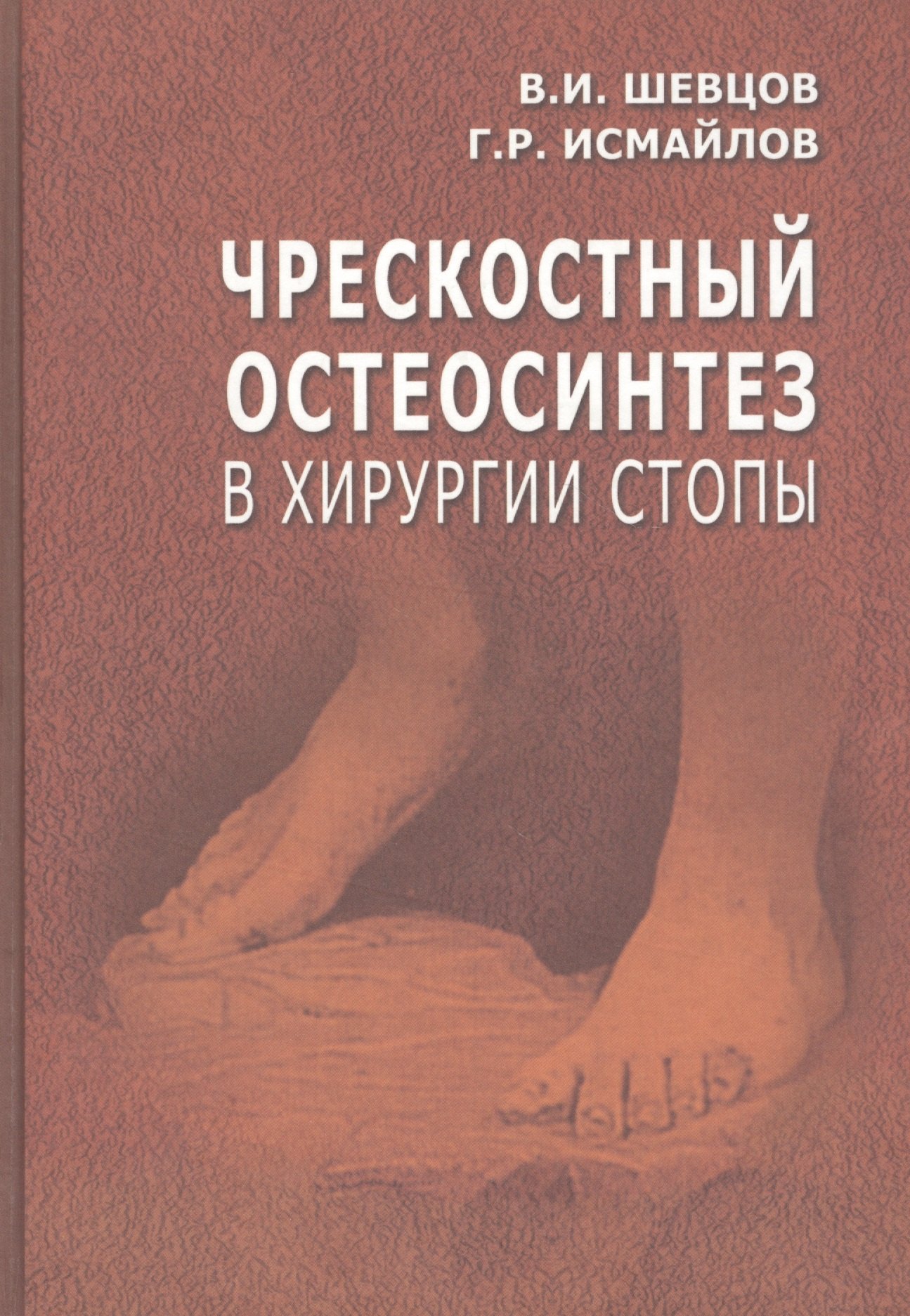 

Чрескостный остеосинтез в хирургии стопы. Руководство для врачей