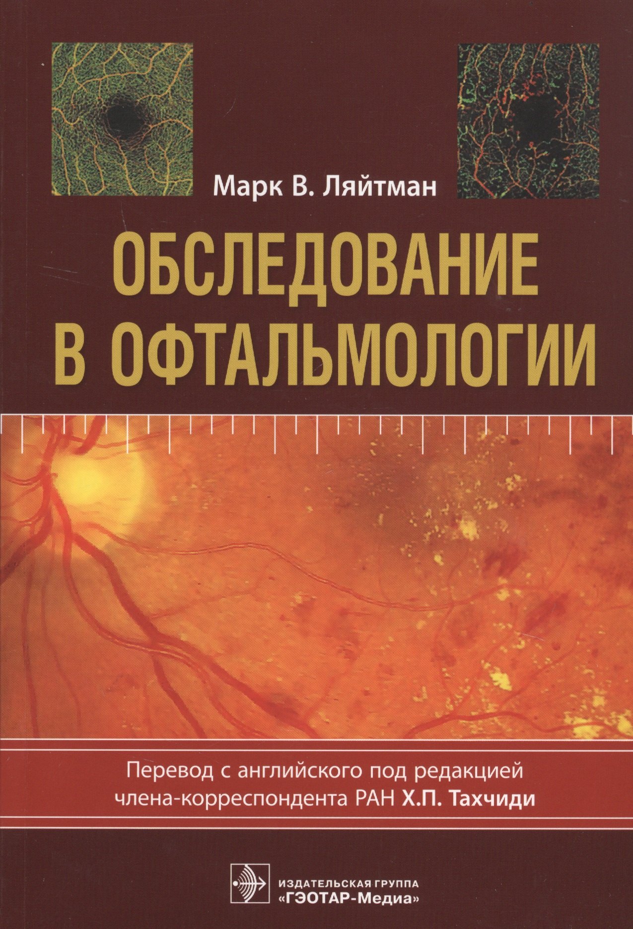 

Обследование в офтальмологии