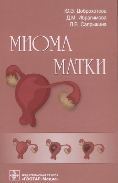 

Миома матки