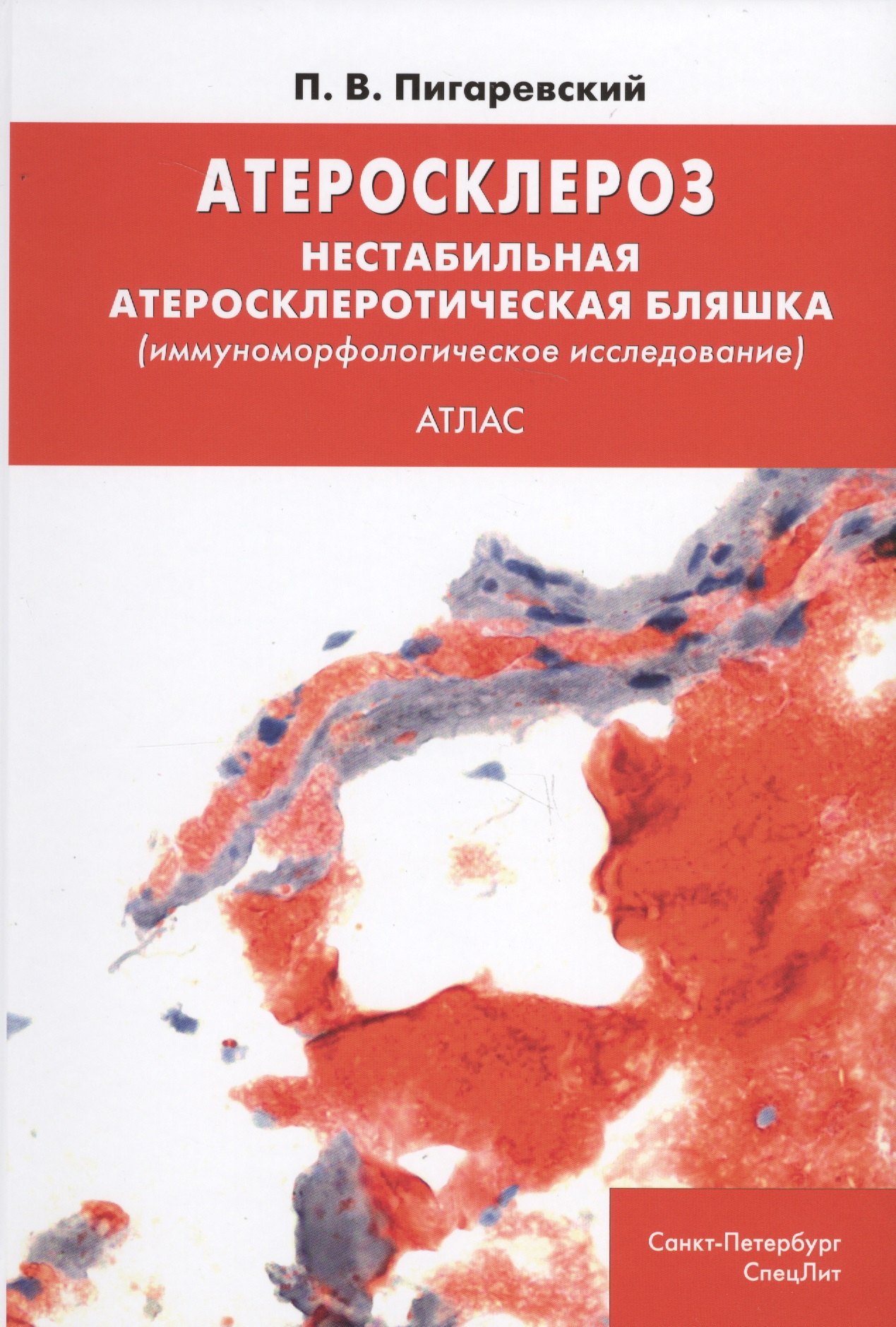 Атеросклероз. Нестабильная атеросклеротическая бляшка (иммуноморфологическое исследование). Атлас