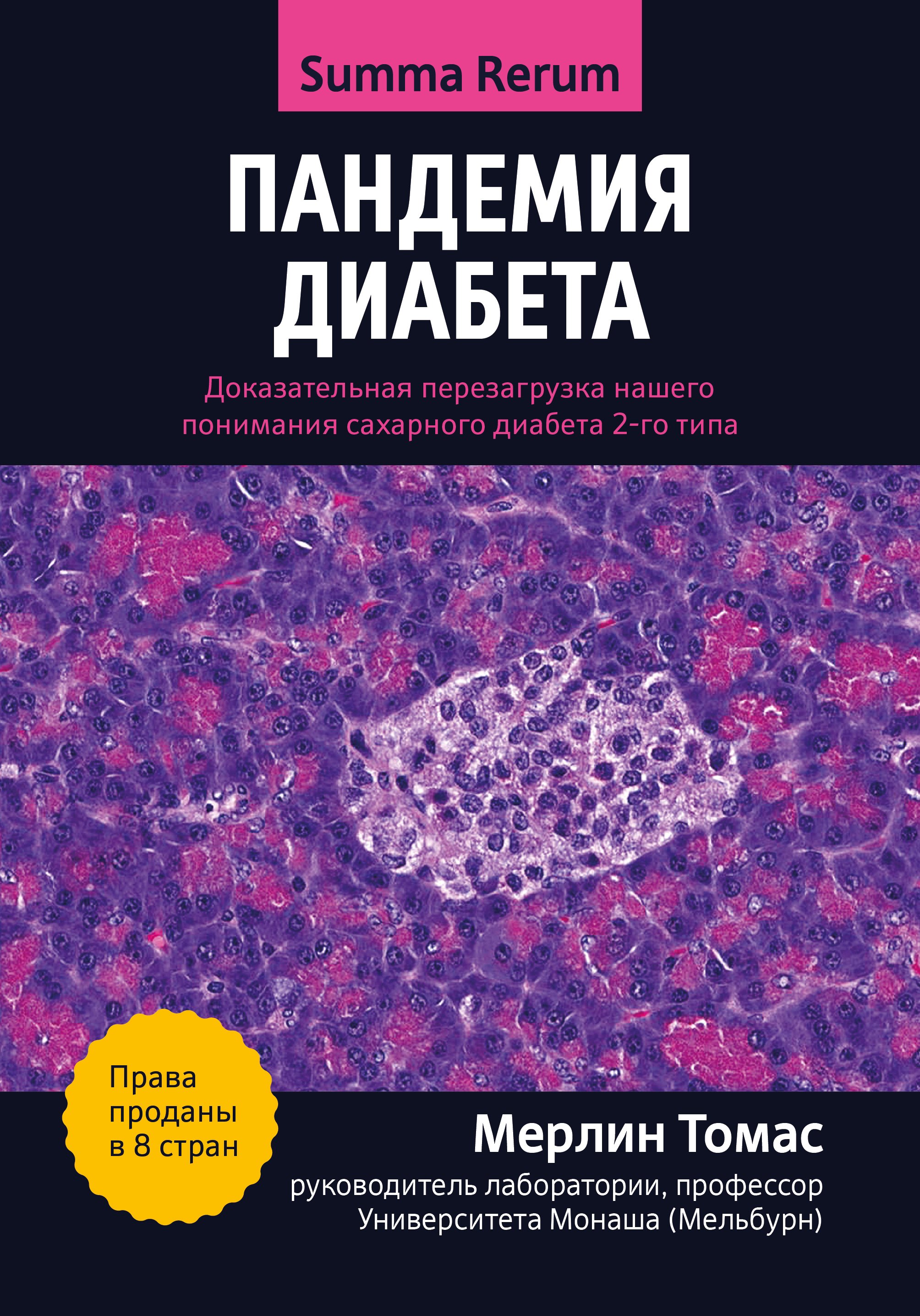 

Пандемия диабета: доказательная перезагрузка нашего понимания сахарного диабета 2-го типа