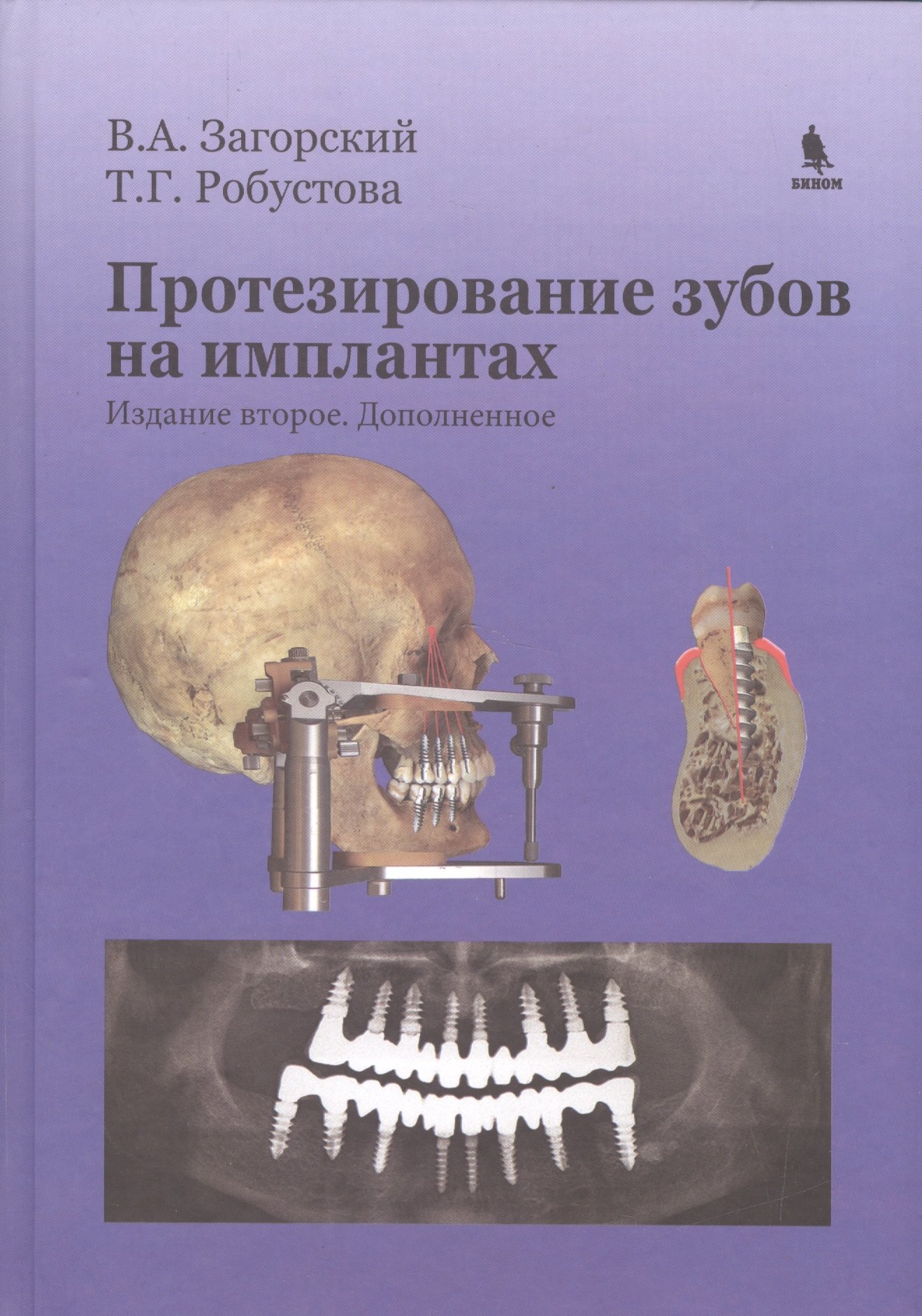 

Протезирование зубов на имплантатах. Изд. 2-е, дополненное