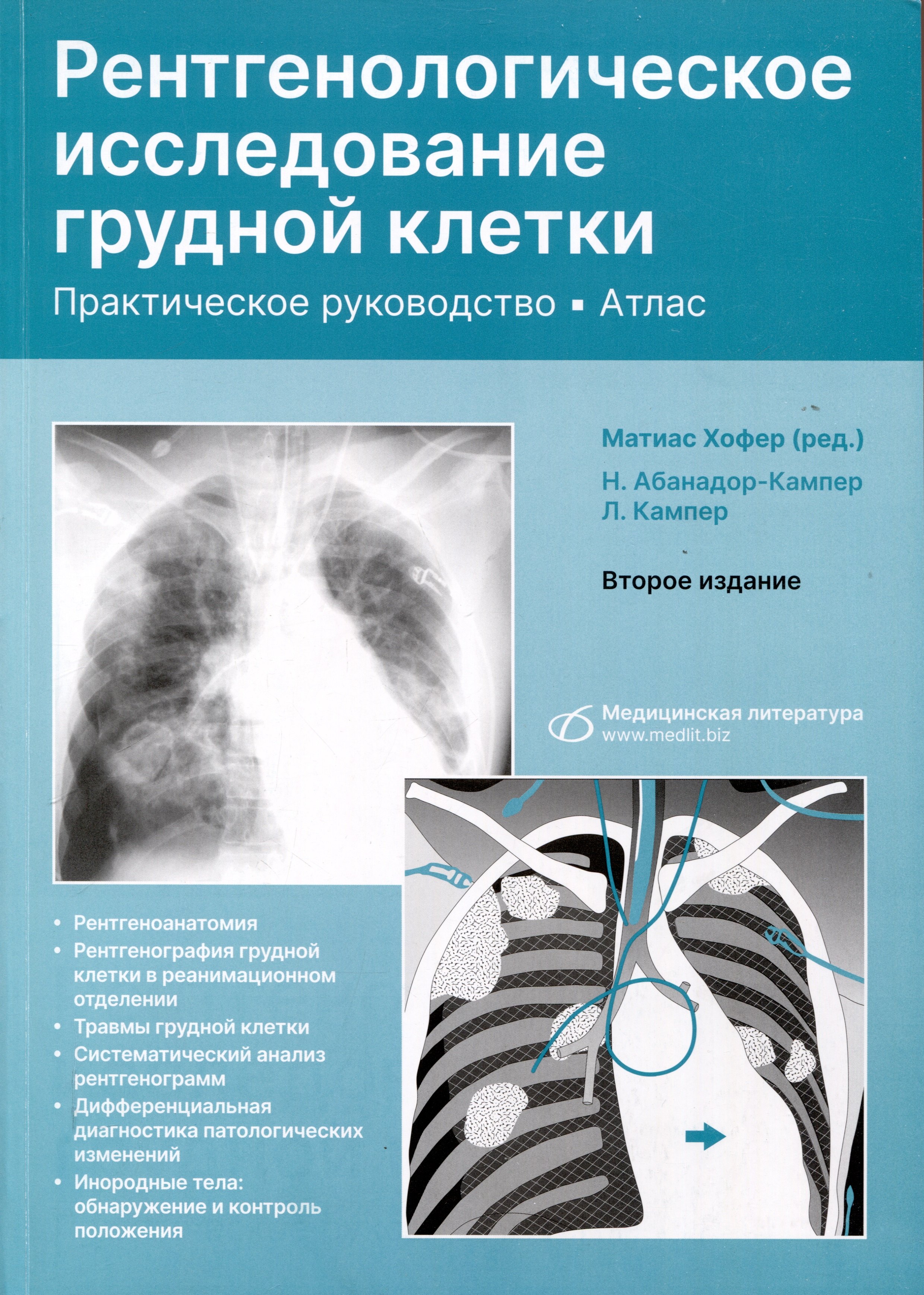 

Рентгенологическое исследование грудной клетки. Практическое руководство. Атлас