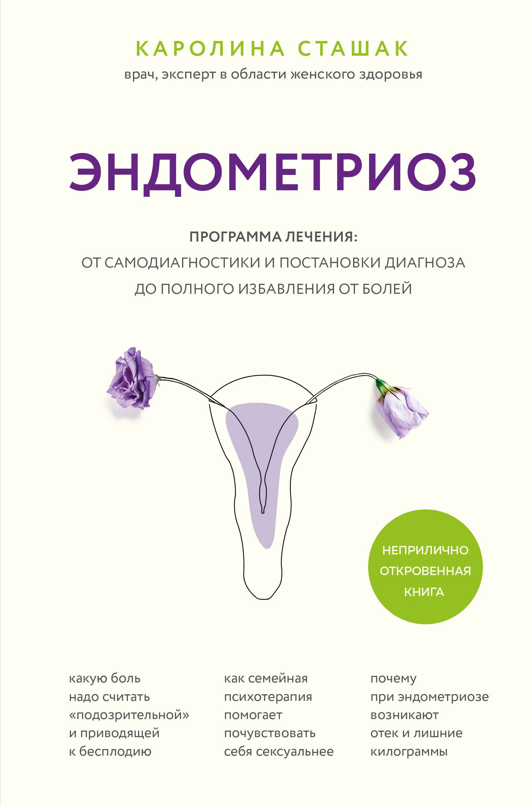 

Эндометриоз. Программа лечения: от самодиагностики и постановки диагноза до полного избавления от болей